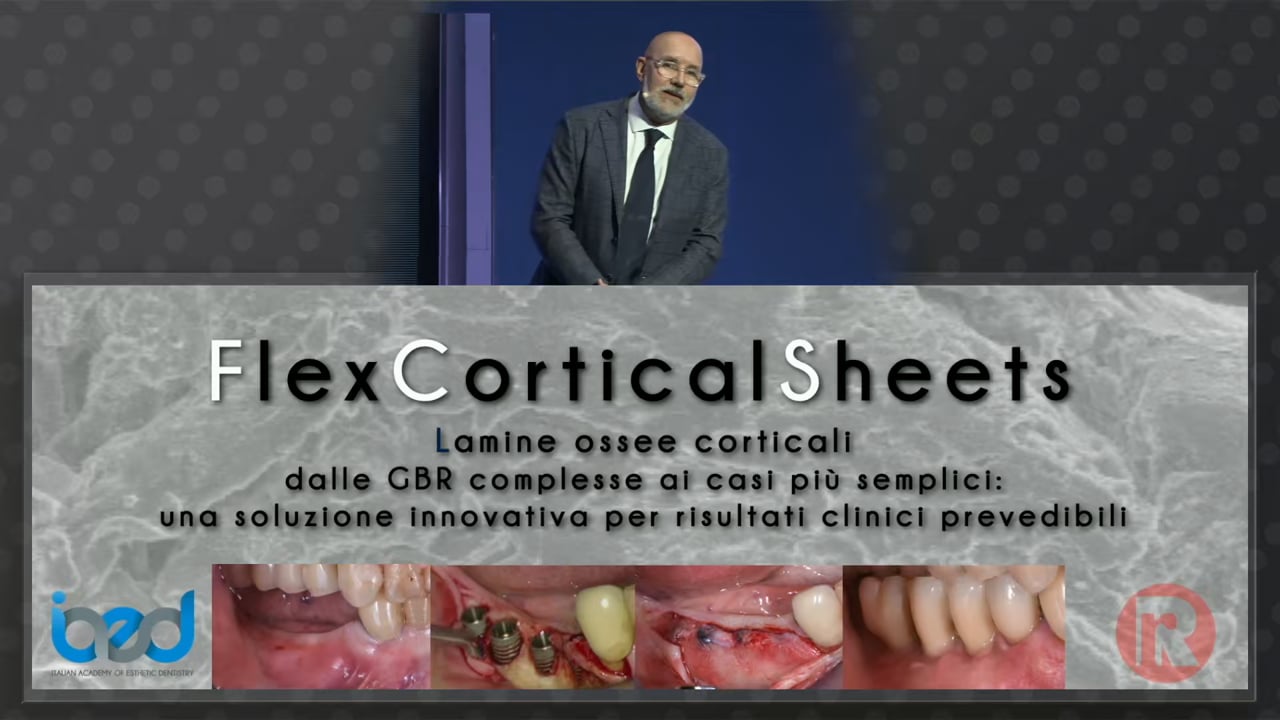 Applicazione delle lamine ossee corticali Flex-Cortical Sheets dalle GBR complesse ai casi più semplici: una soluzione innovativ